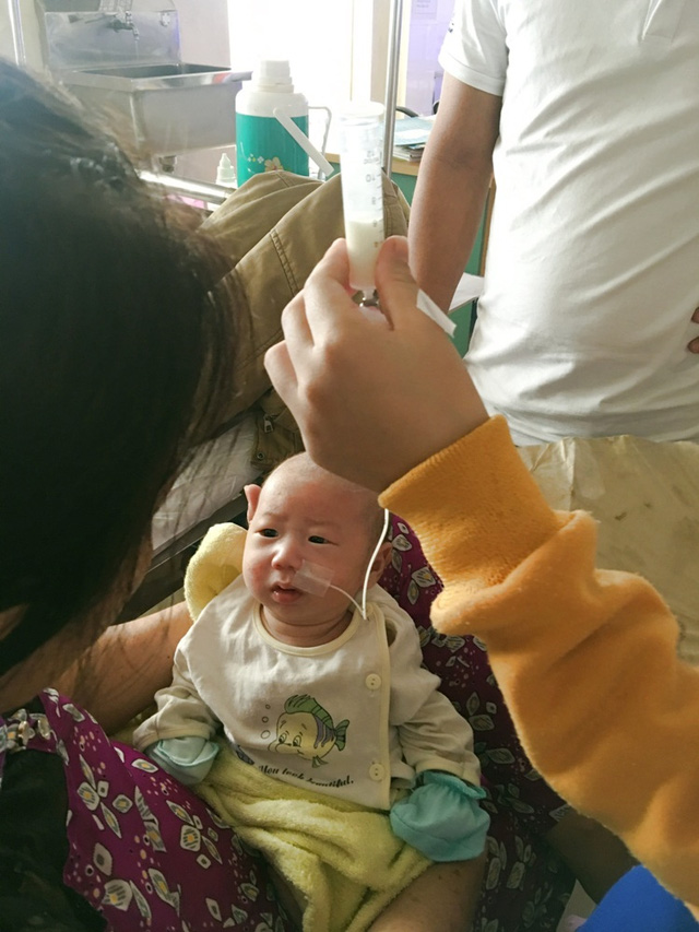 Xót xa bé 3 tháng tuổi phải dùng ống xông sữa để duy trì sự sống - Ảnh 1.
