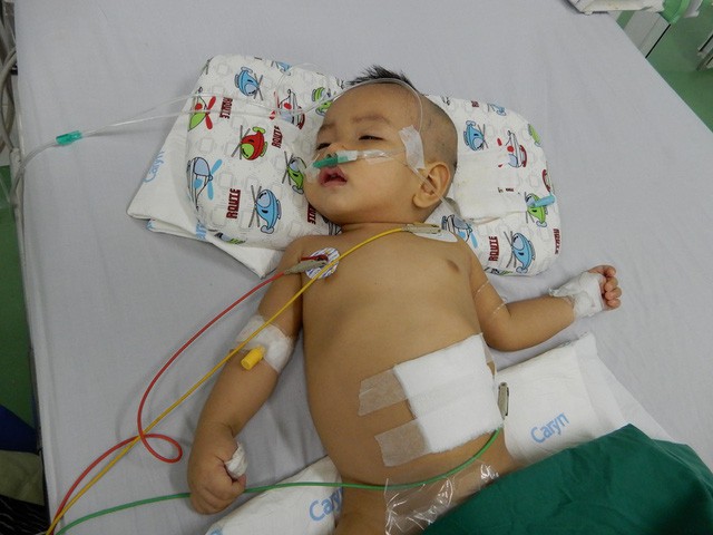 Thương cháu bé 11 tháng tuổi bị não úng thủy - Ảnh 1.