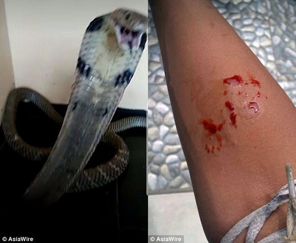 Bị rắn hổ mang cắn, thiếu niên chụp ảnh “khoe” lên mạng xã hội rồi tử vong - Ảnh 1.