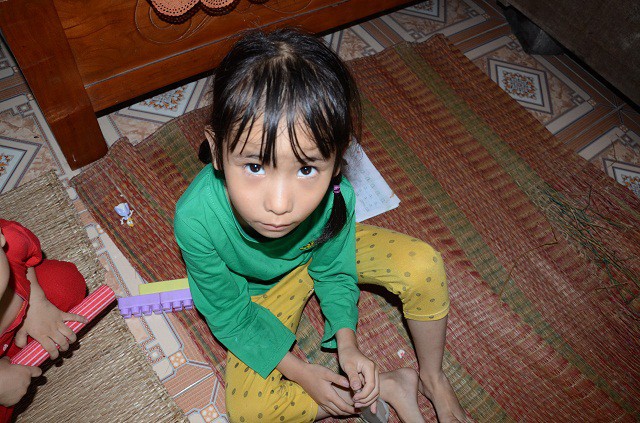 Ánh mắt đáng thương của bé 7 tuổi bị thiểu năng trí tuệ - Ảnh 2.