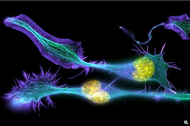 Các nhà khoa học phát hiện bộ não già vẫn luôn sinh ra tế bào mới - Ảnh 1.