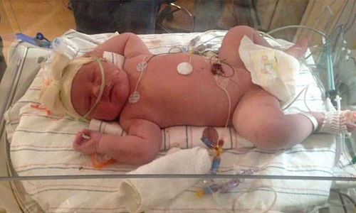 Mỹ: Em bé chào đời nặng gần 7 kg tại New York - Ảnh 1.