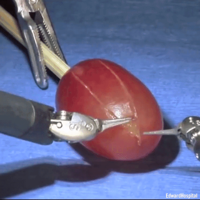 Robot phẫu thuật “khoe” khả năng đáng kinh ngạc bằng cách mổ… một quả nho - Ảnh 1.