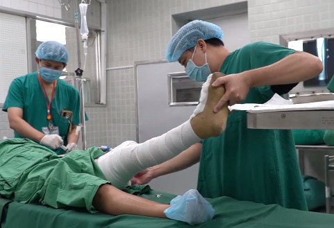 Lần đầu tiên tại Việt Nam: Sử dụng mảnh ghép in 3D hợp kim Titanium thay thế xương chày mất đoạn - Ảnh 1.
