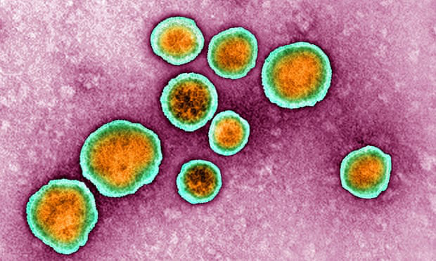 Làn sóng lây nhiễm virus hợp bào hô hấp nghiêm trọng tại Thụy Điển - Ảnh 1.