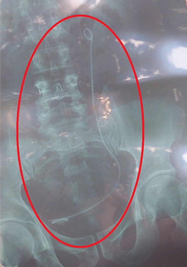 Bệnh viện trả nhầm kết quả X-quang, bệnh nhân bị phẫu thuật oan - Ảnh 1.