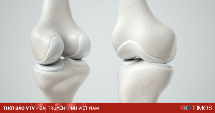 China develops artificial joint cartilage with high durability