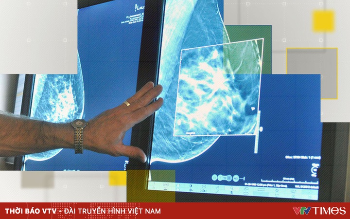 A record 2.7 million people in the UK will be referred for cancer screening in 2021