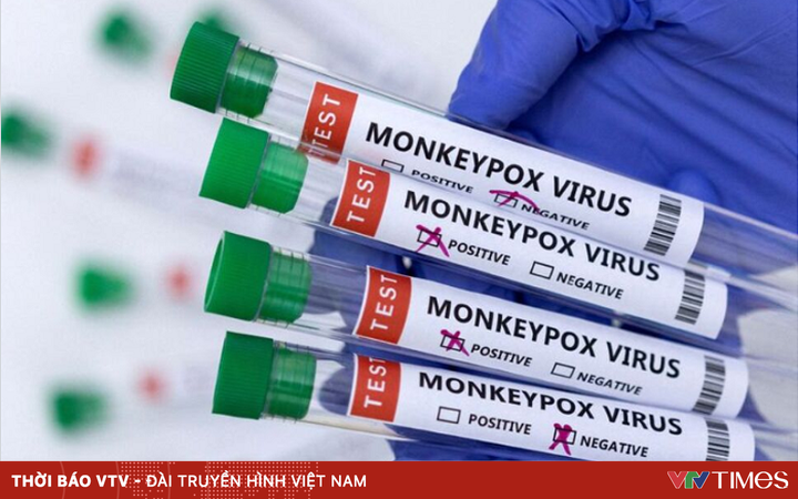 US confirms 9 cases of monkeypox in 7 states