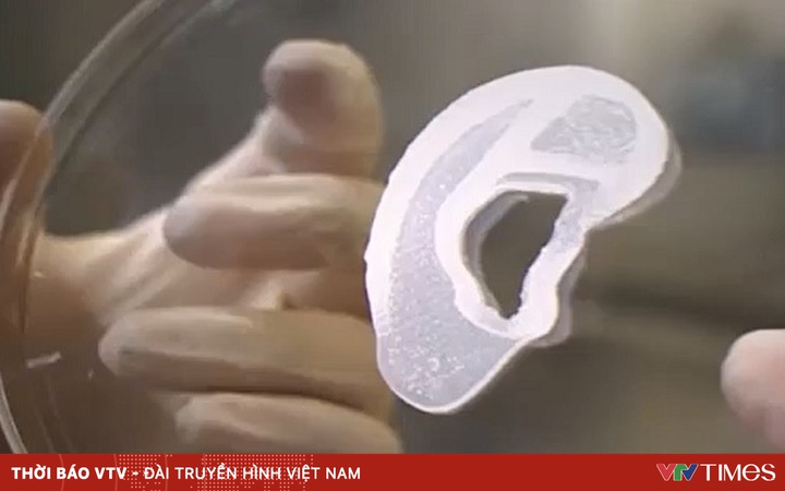 The US has successfully implanted a 3D printed human ear for the first time