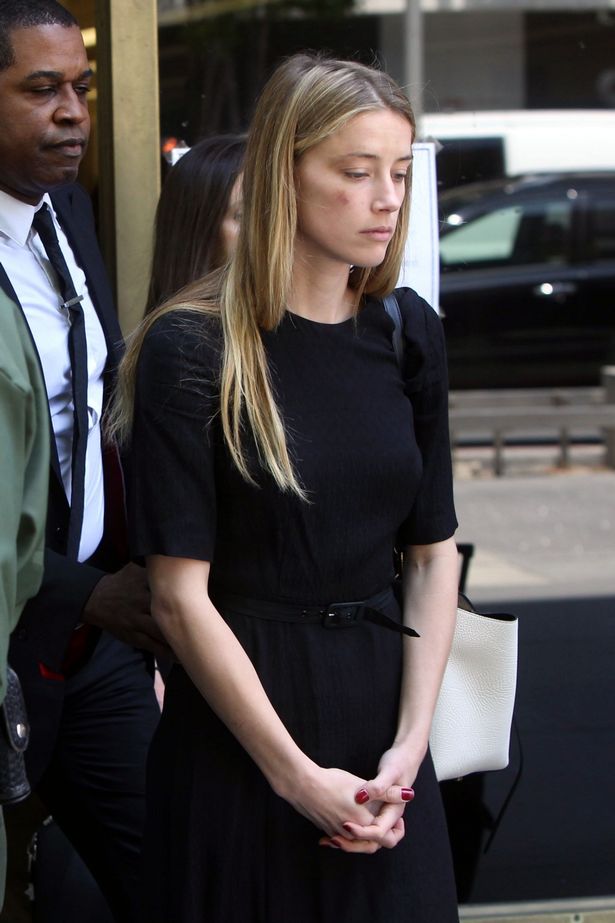 
Amber Heard xuất hiện với hình ảnh đáng thương bên ngoài tòa án, sau khi đệ đơn ly hôn với Johnny Depp. Cô tố cáo Johnny Depp đã bạo hành mình trong suốt khoảng thời gian 15 tháng cả hai chung sống. Vết bầm trên gương mặt Amber, theo cáo buộc của cô, là hậu quả của cú ném iPhone mà Johnny đã để lại.
