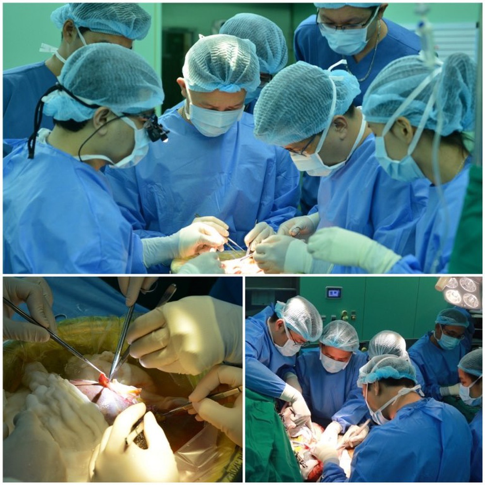Hành trình xuyên Việt, xuyên đêm vận chuyển, ghép tạng cho bệnh nhân xơ gan - Ảnh 6.