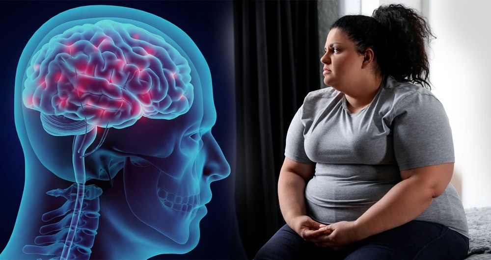 Những mối liên hệ giữa bệnh béo phì và chức năng não | VTV.VN