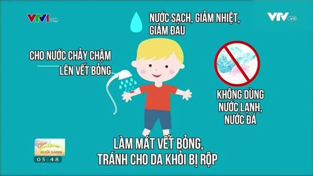 Cách sơ cứu khi trẻ bị bỏng nước sôi - Ảnh 1.