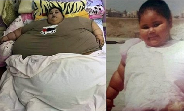 Người phụ nữ nặng cân nhất thế giới giảm được 300kg sau phẫu thuật - Ảnh 1.