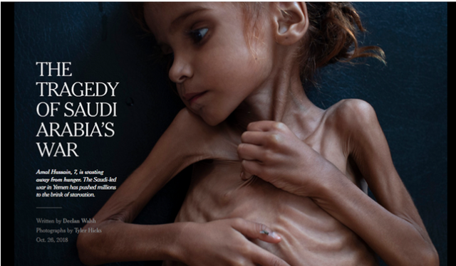Facebook bị phản đối vì kiểm duyệt ảnh em bé Yemen trong nạn đói - Ảnh 1.