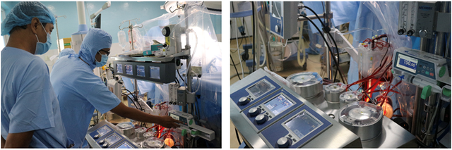 Phát triển kỹ thuật phẫu thuật tim hở ở bệnh viện tuyến dưới - Ảnh 2.