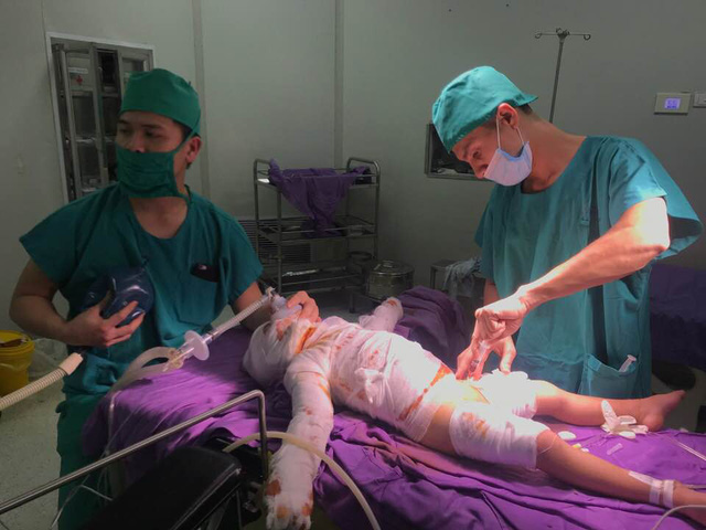 Quảng Ninh: Cấp cứu bé 4 tuổi bị bỏng nước sôi ngay trong đêm giao thừa - Ảnh 1.