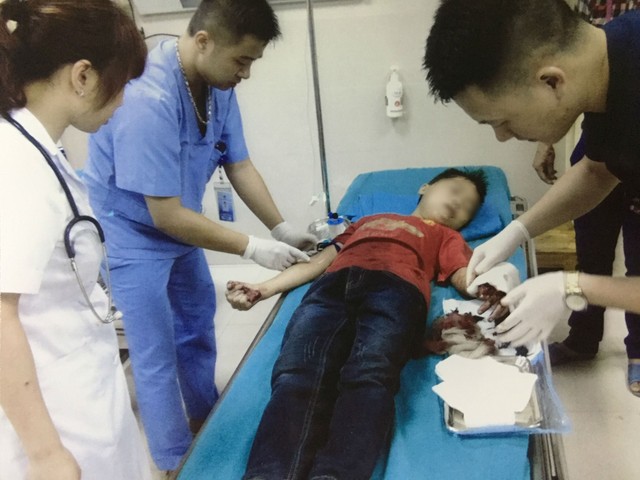 Bị trượt tay lúc phụ mẹ thái chuối, bé trai bị cắt mất ngón tay - Ảnh 1.