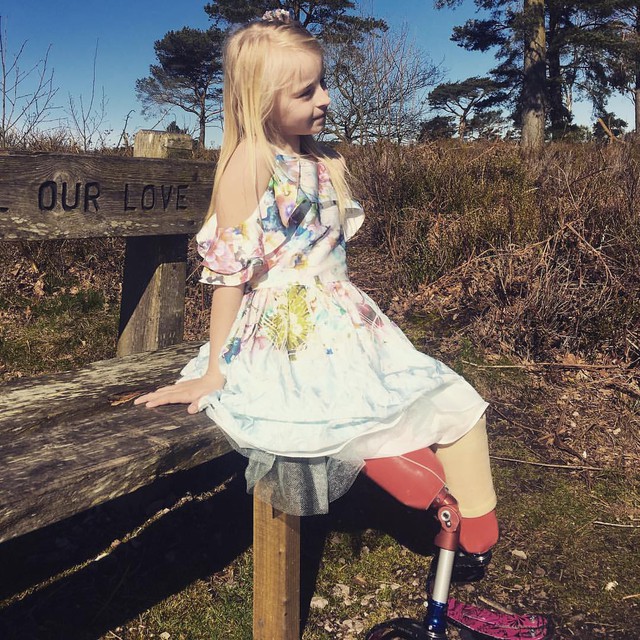 Cô bé 7 tuổi khuyết tật bẩm sinh gây chấn động làng thời trang thế giới - Ảnh 3.