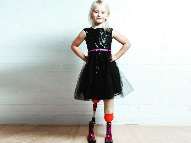 Cô bé 7 tuổi khuyết tật bẩm sinh gây chấn động làng thời trang thế giới - Ảnh 4.