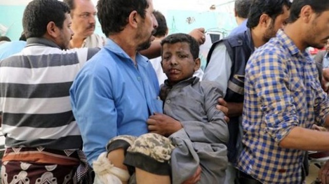 Tấn công xe bus ở Yemen, ít nhất 43 người thiệt mạng - Ảnh 1.