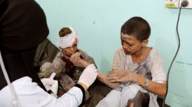Tấn công xe bus ở Yemen, ít nhất 43 người thiệt mạng - Ảnh 2.