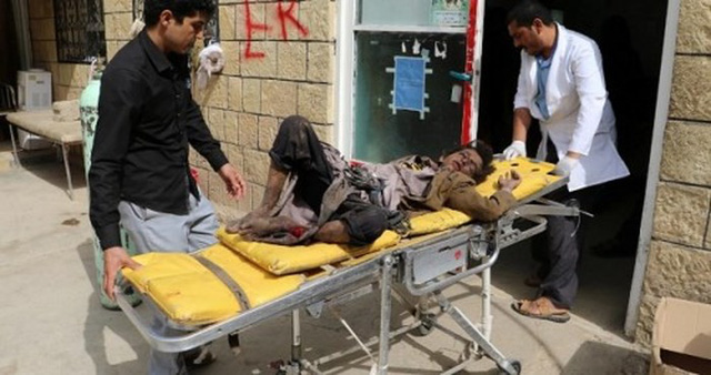 Tấn công xe bus ở Yemen, ít nhất 43 người thiệt mạng - Ảnh 4.