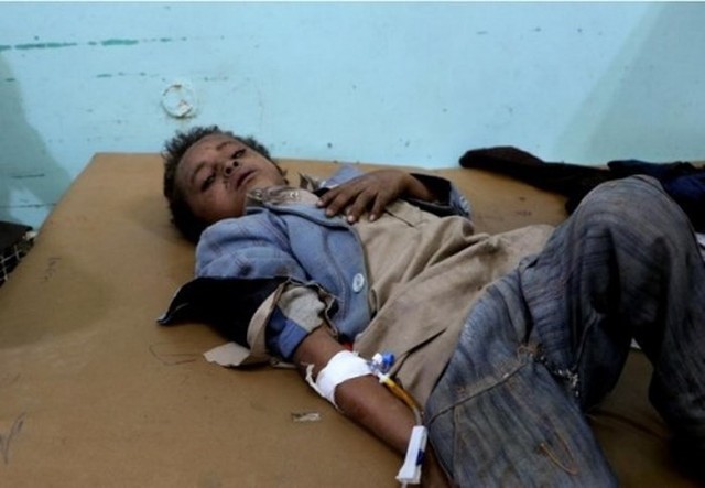 Tấn công xe bus ở Yemen, ít nhất 43 người thiệt mạng - Ảnh 5.