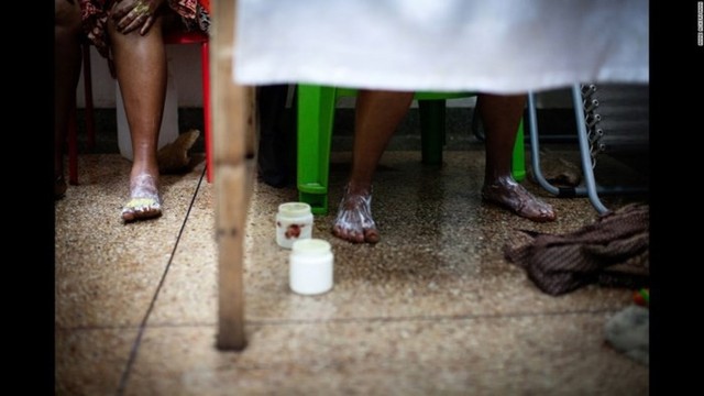 Báo động tình trạng lạm dụng kem tẩy trắng da ở châu Phi - Ảnh 4.