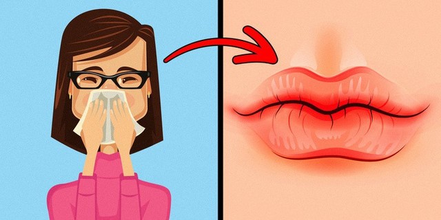 8 dấu hiệu của đôi môi tiết lộ tình trạng sức khỏe của bạn - Ảnh 2.