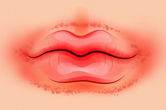 8 dấu hiệu của đôi môi tiết lộ tình trạng sức khỏe của bạn - Ảnh 4.