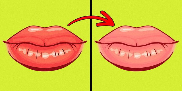 8 dấu hiệu của đôi môi tiết lộ tình trạng sức khỏe của bạn - Ảnh 6.