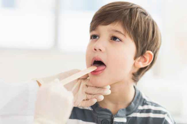 Nhận biết tình trạng sức khỏe qua các dấu hiệu của miệng - Ảnh 5.