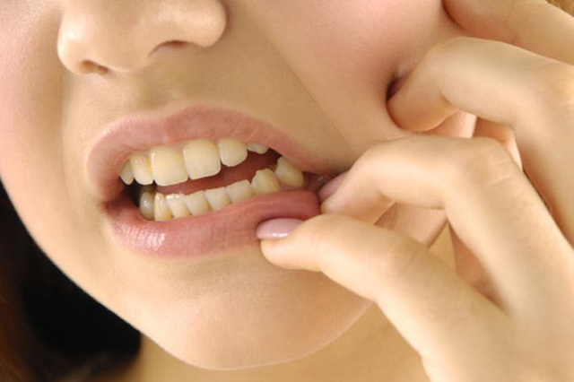 Nhận biết tình trạng sức khỏe qua các dấu hiệu của miệng - Ảnh 9.