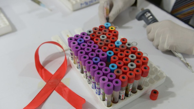 Sắp thử nghiệm vaccine ngừa HIV/AIDS trên người sau 8 năm nghiên cứu - Ảnh 1.