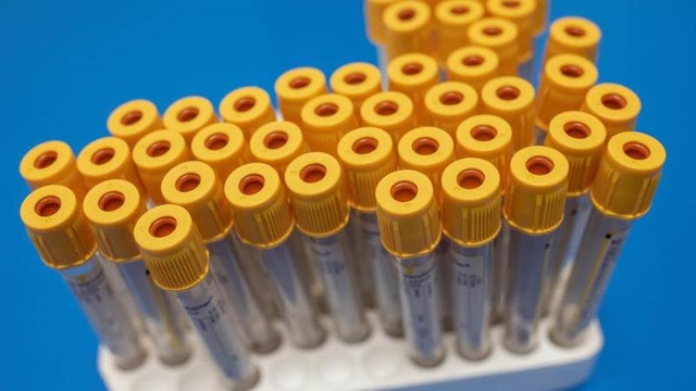 Singapore bắt đầu thử nghiệm giai đoạn cuối kháng thể chống virus SARS-CoV-2 - Ảnh 1.