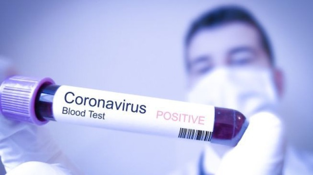 Đại dịch COVID-19: Các nhà khoa học tìm ra điểm yếu của virus - Ảnh 1.
