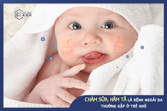 Vai trò quan trọng của lợi khuẩn trong việc bảo vệ làn da cho bé yêu - Ảnh 2.