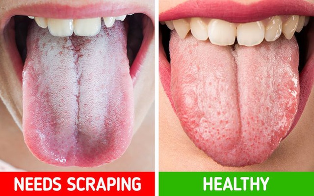 10 bí quyết chăm sóc răng miệng giúp bạn không bao giờ phải gặp nha sĩ - Ảnh 10.