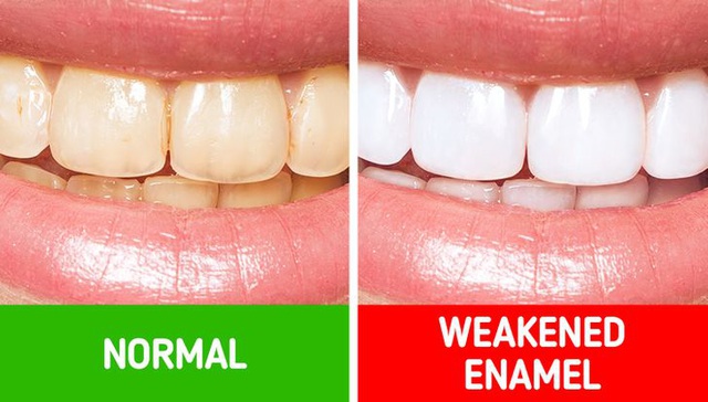 10 bí quyết chăm sóc răng miệng giúp bạn không bao giờ phải gặp nha sĩ - Ảnh 3.