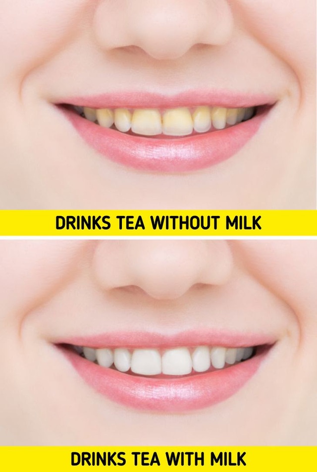 7 lời khuyên từ chuyên gia giúp răng trắng và khỏe mạnh - Ảnh 1.