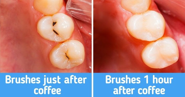 7 lời khuyên từ chuyên gia giúp răng trắng và khỏe mạnh - Ảnh 2.
