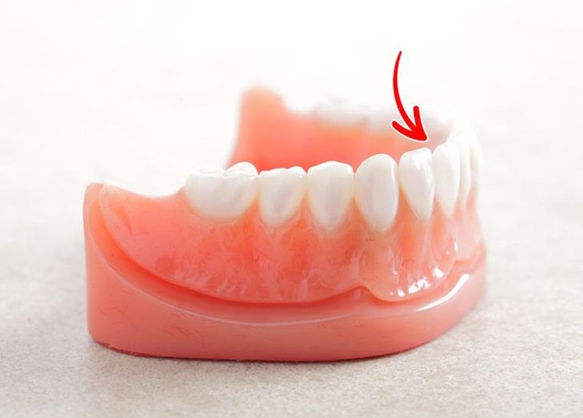 7 lời khuyên từ chuyên gia giúp răng trắng và khỏe mạnh - Ảnh 4.