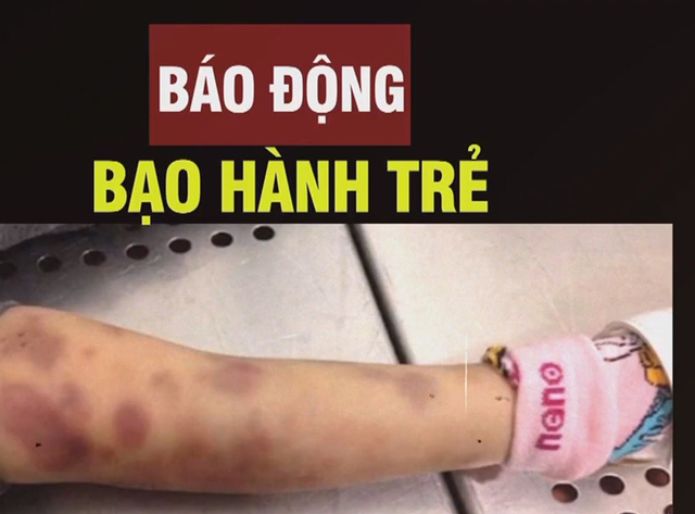 Báo động Tình Trạng Bạo Hành Trẻ Em Vtvvn 