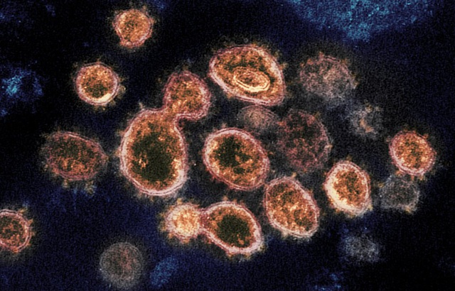 Người nhiễm biến thể Delta có thể lây lan virus 2 ngày trước khi có triệu chứng - Ảnh 1.