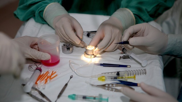 Thừa Thiên - Huế: Bệnh nhân được ghép giác mạc đăng ký hiến tạng trong ngày ra viện - Ảnh 1.