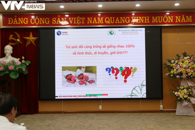 Phát hiện ca song thai cùng trứng, khác kiểu hình và kiểu gen ở Việt Nam - Ảnh 2.