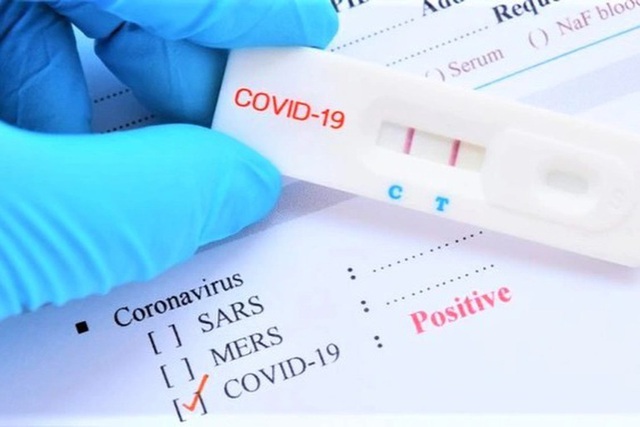 Bộ Y tế đề nghị sớm xem xét đưa kit xét nghiệm COVID-19 vào diện bình ổn giá - Ảnh 1.