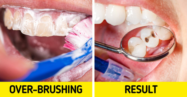 Tác hại của việc đánh răng quá nhiều lần một ngày - Ảnh 3.